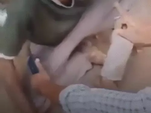 CG NEWS : जबरदस्त पिटाई में व्यक्ति को 80 से ज्यादा चोटें, डॉक्टर बोले– शरीर का कोई हिस्सा सुरक्षित नहीं